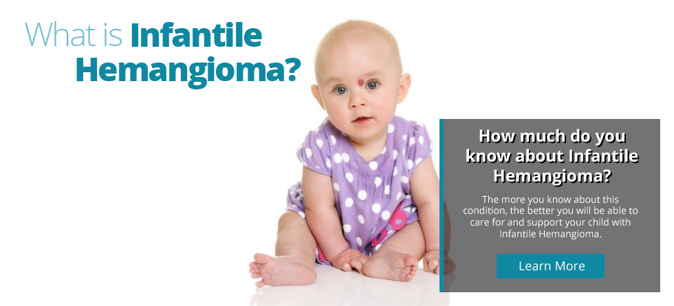 What is Infantile Hemangioma?